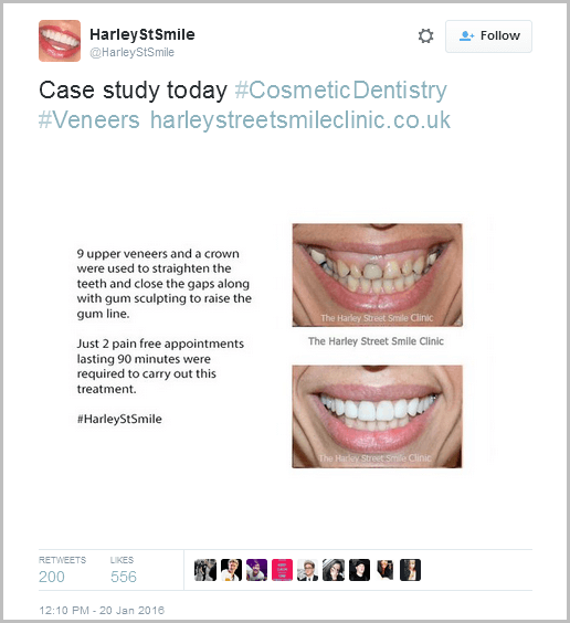 Case Study Tweet